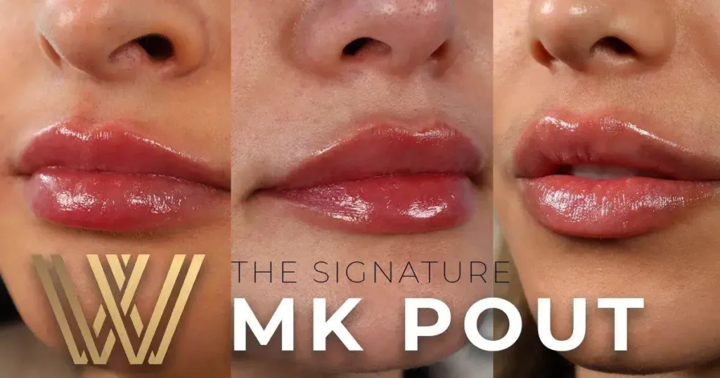 THE SIGNATURE MK POUT ORLANDO FLORIDA LIP FILLER