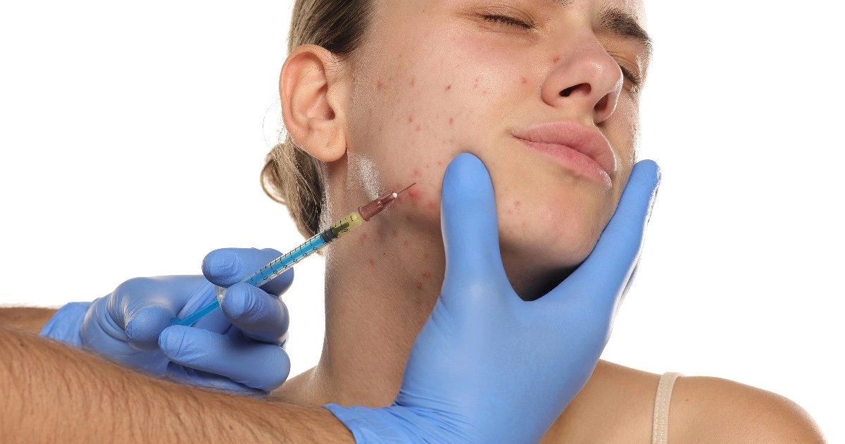 Women receiving acne injections in Orlando, FL,
