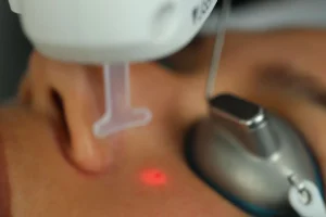 Lasers Treatment in Orlando, FL | Windermere Medical Spa