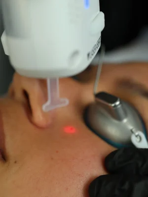 Lasers Treatment in Orlando, FL | Windermere Medical Spa